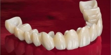 Zirconium Based Porclain Crowns    