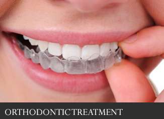 Şeffaf plak ile eğri dişlerin düzeltilmesi mümkündür.